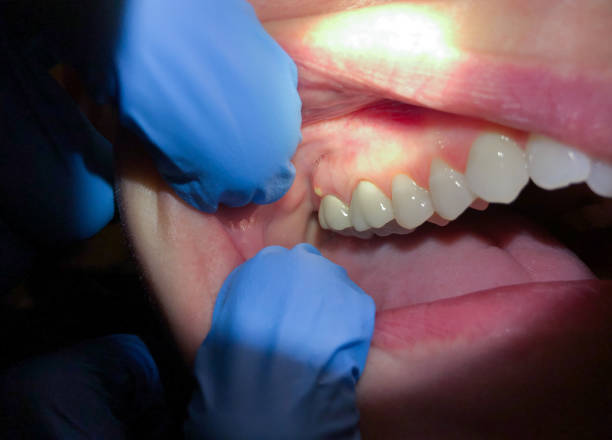 Best Pediatric Emergency Dentist in Winters, TX