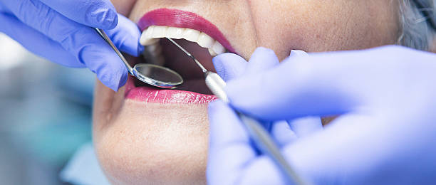 Best Emergency Dental Extractions in Winters, TX